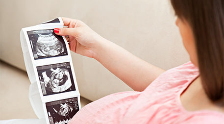 Pregnant woman looking at ultrasound scans