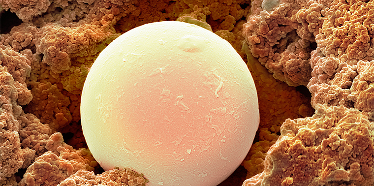 Sunscreen microsphere