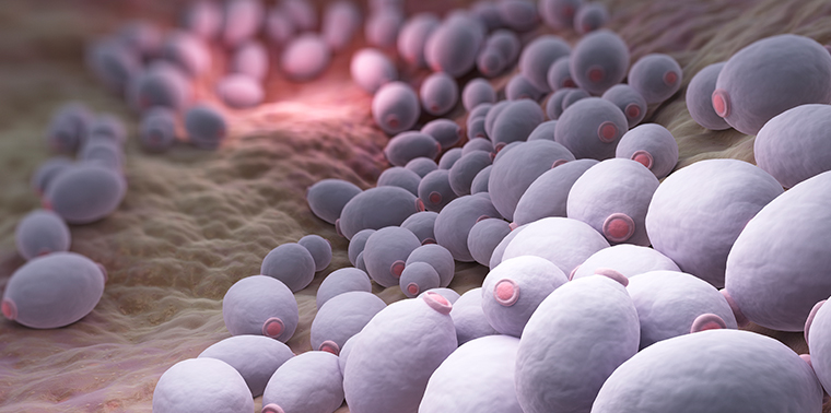 Figure 4 from Fungal Infections From Human and Animal Contact